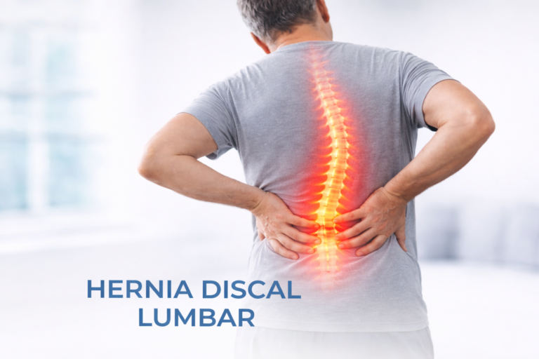 Hernia discal lumbar hernia discal lumbar (2)