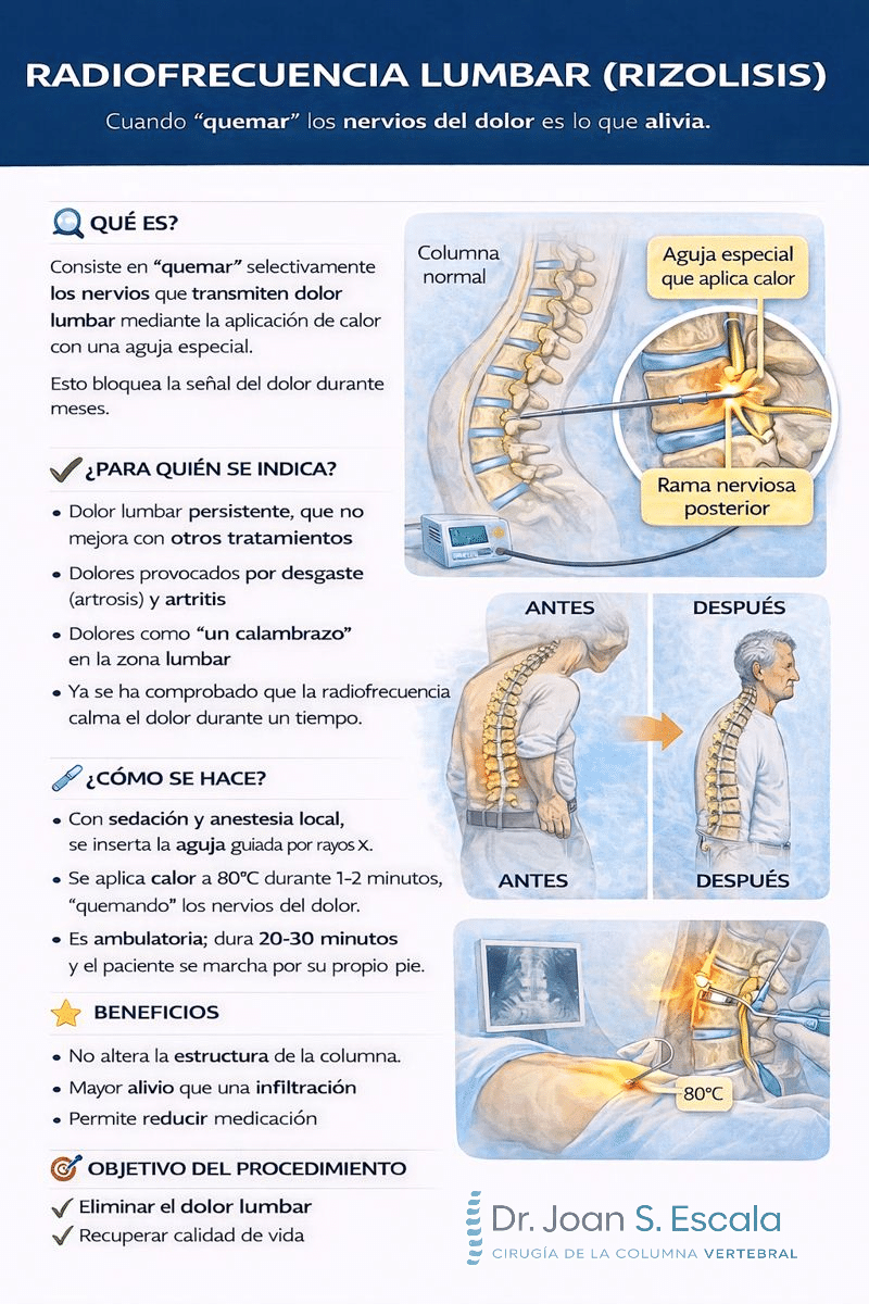 Cirugía de columna radiofrecuencia lumbar (rizolisis)